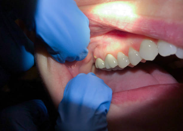 Best Urgent Care for Lost Fillings or Crowns in Fulton, MO
