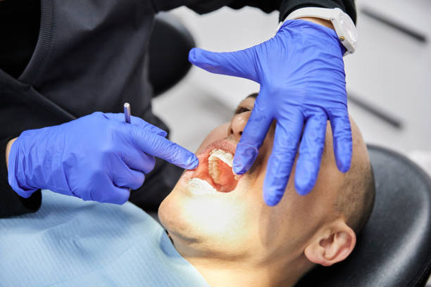 Best Emergency Treatment for Dental Infections or Abscesses in Fulton, MO